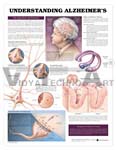    Understanding Alzheimer's Anatomical Chart, 1st Edition - Paper